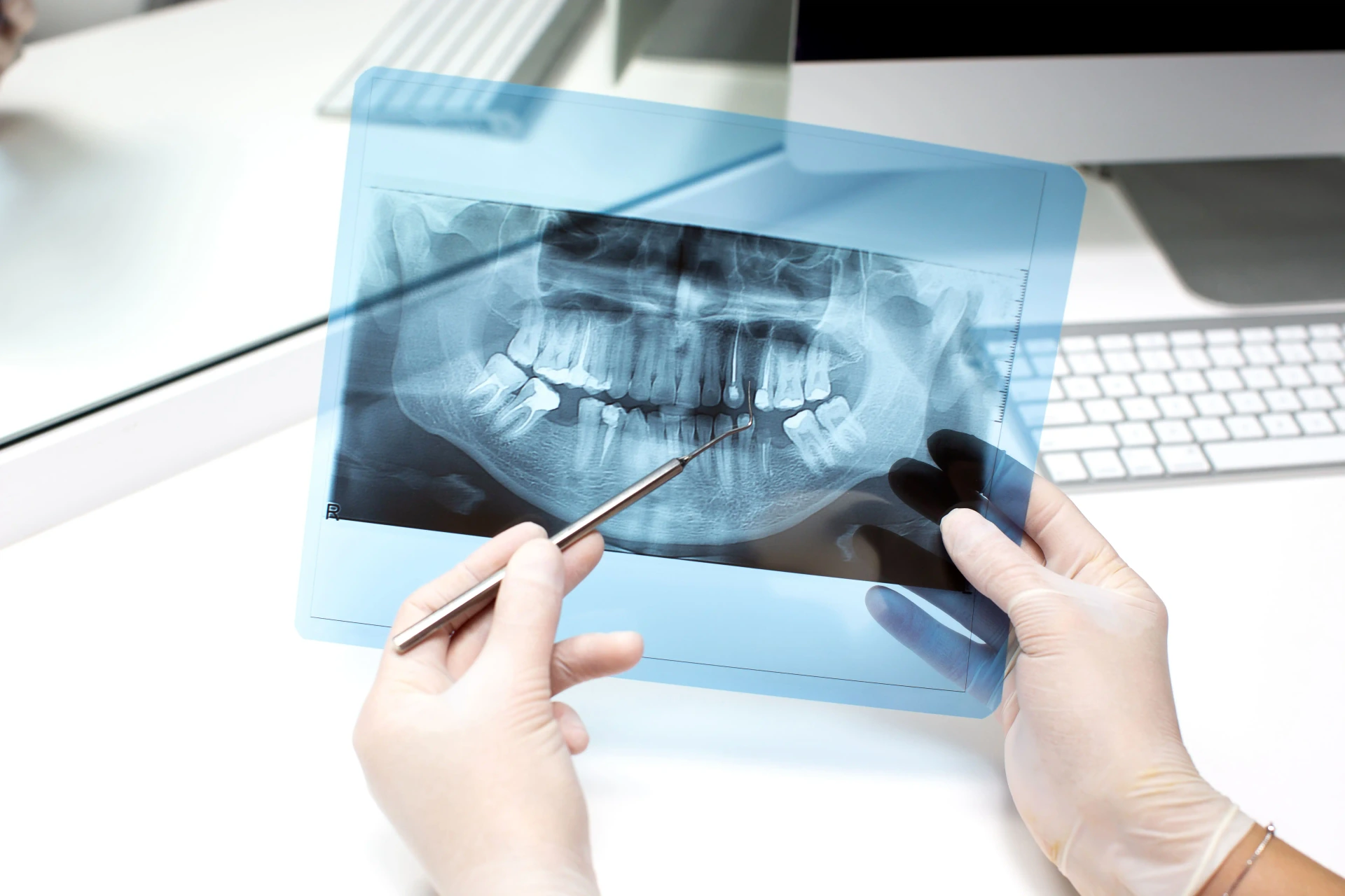 Digital Dental X-Ray