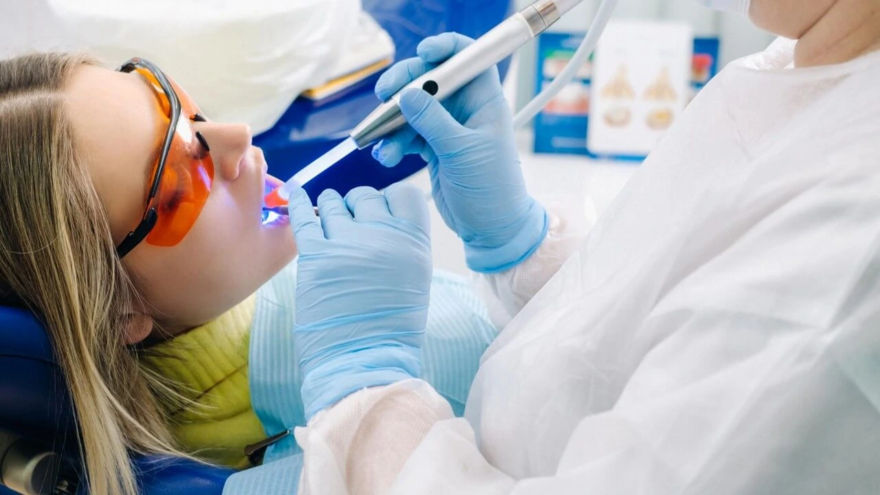 Dental Filling